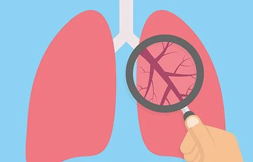Missverständnis der Sauerstofftherapie bei COPD